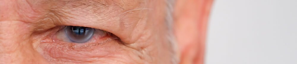 Examination,And,Treatment,Of,Patients,With,Cataract,And,Glaucoma,Eyes.