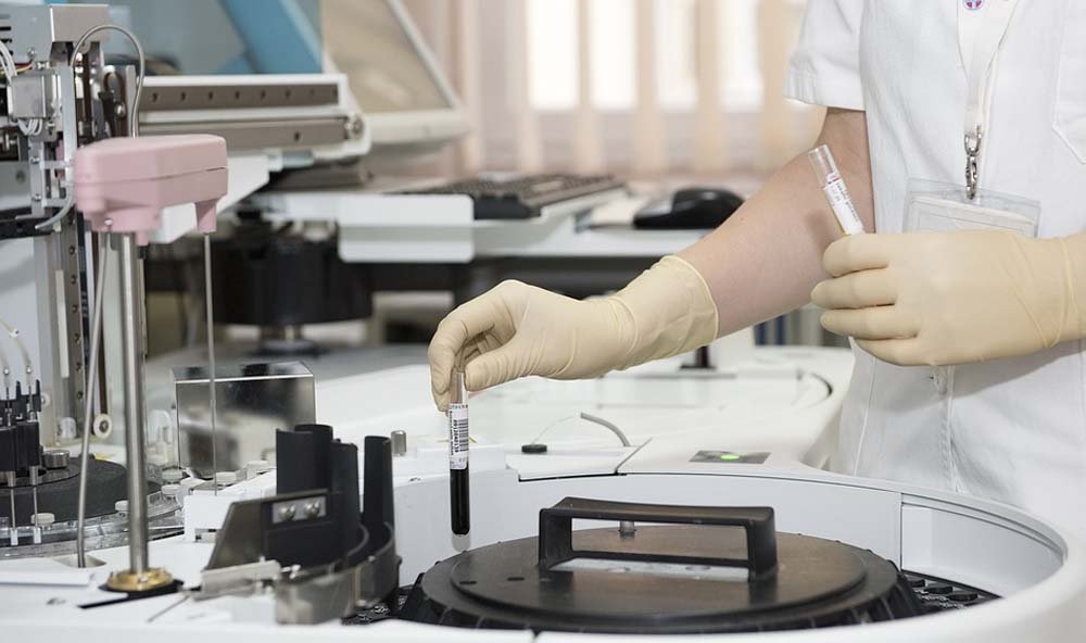 Böbrek Sağlığınızı Rutin Tetkiklerle Koruyabilirsiniz